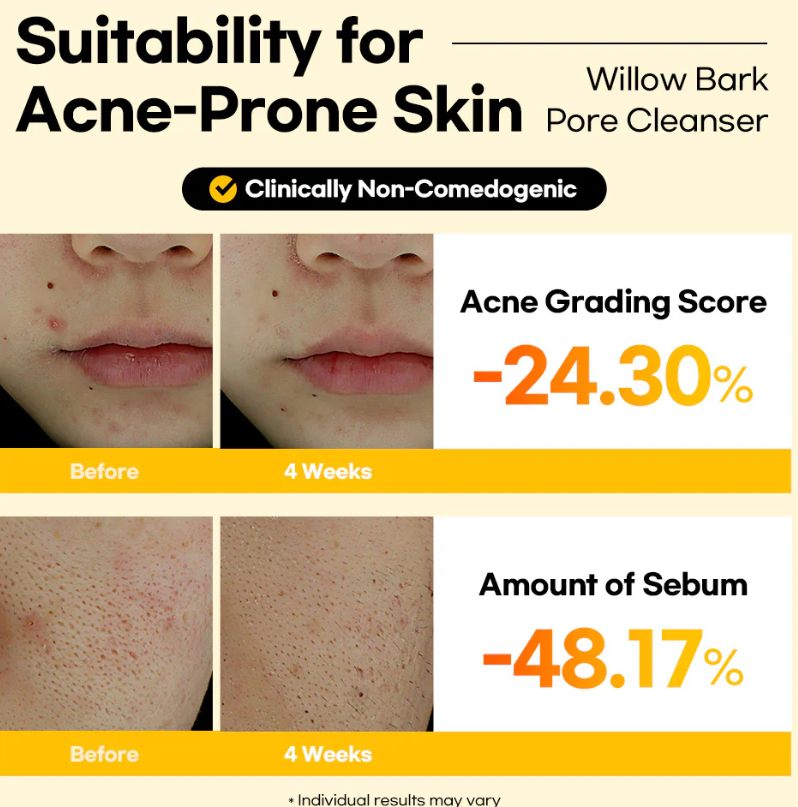 Stayve Lesimo Willow Bark Pore Cleanser