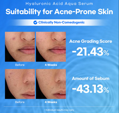 Stayve Lesimo Hyaluronic Acid Serum