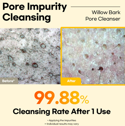 Stayve Lesimo Willow Bark Pore Cleanser