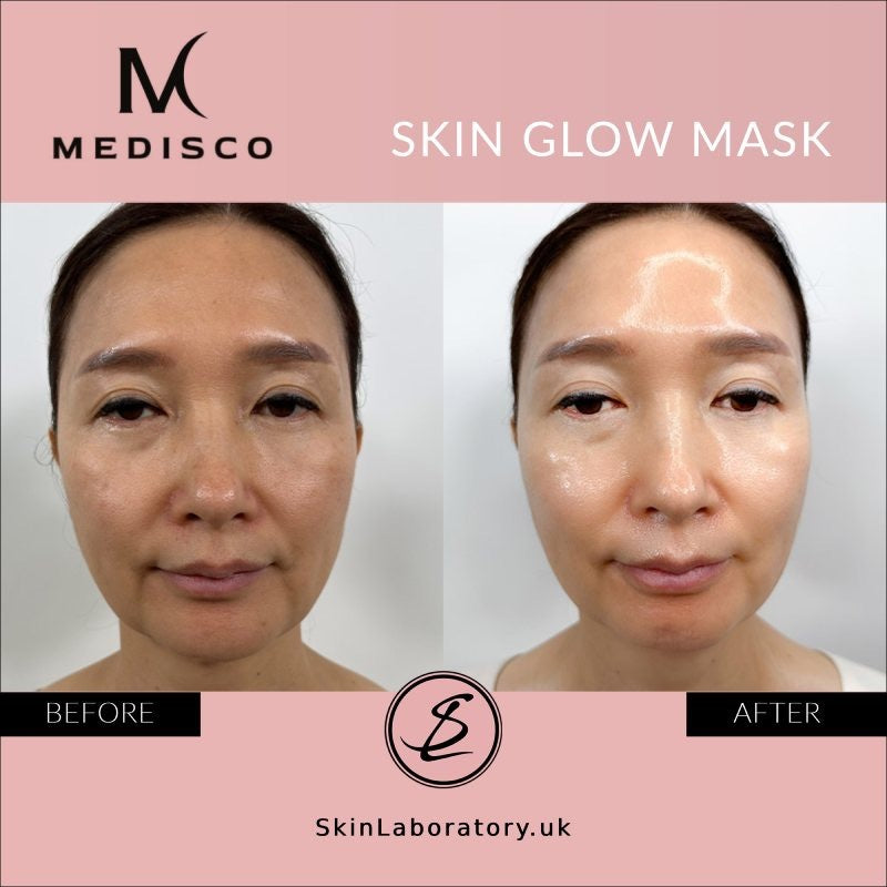 Medisco Skin Glow Mask