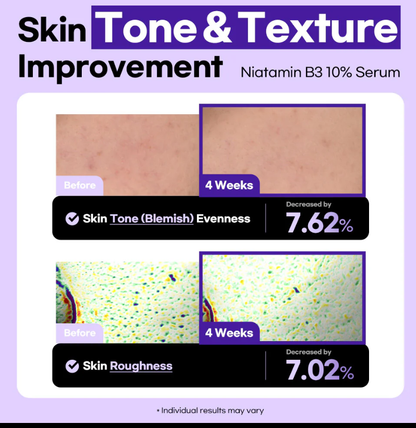 Stayve Lesimo Niatamin B3 10% Serum