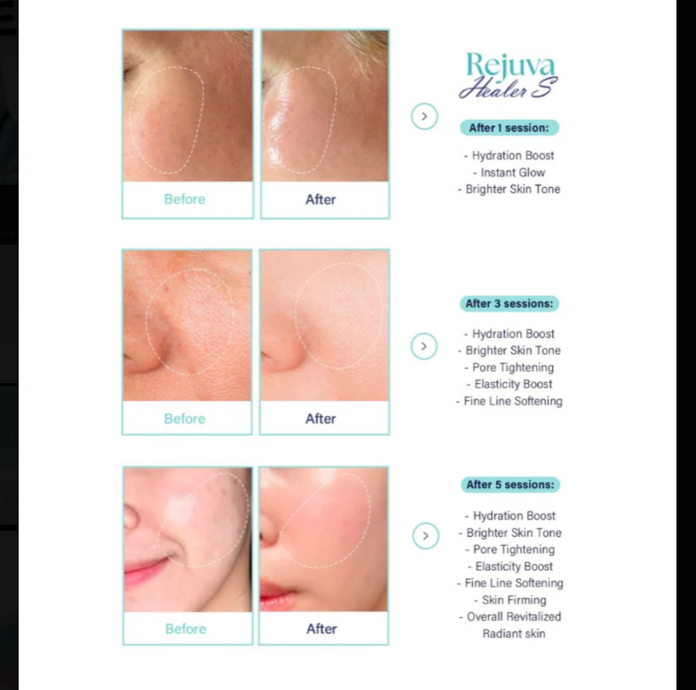 Rejuva Healer S Skin Booster