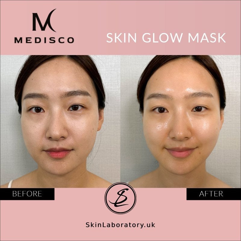 Medisco Skin Glow Mask
