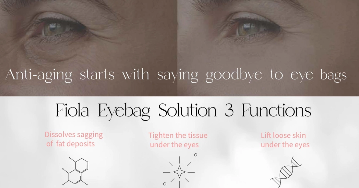 Fiola Eyebag Solution