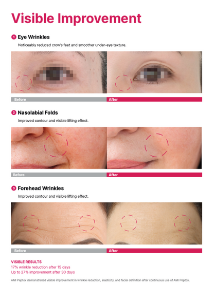 AMI Peptox Skin Booster