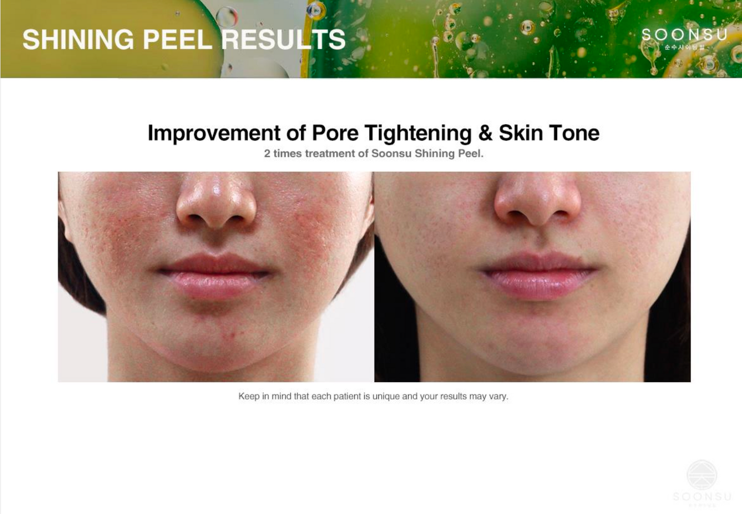 Soonsu Shining Peel