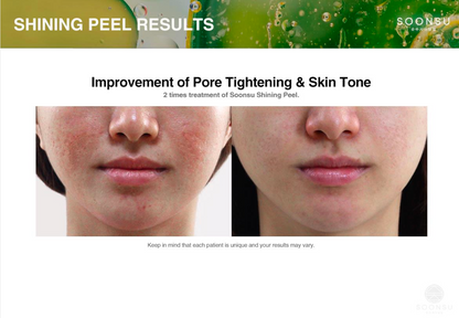 Soonsu Shining Peel