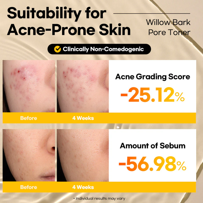 Stayve Lesimo Willow Bark Pore Toner