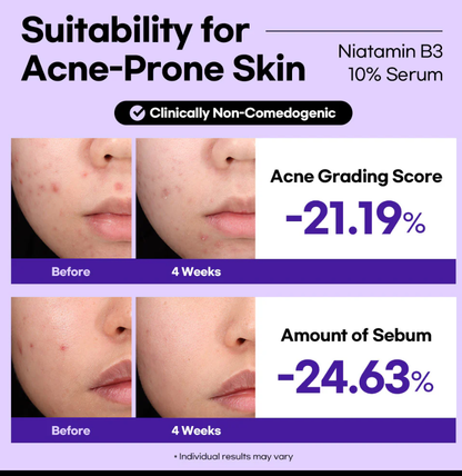 Stayve Lesimo Niatamin B3 10% Serum