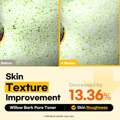 Stayve Lesimo Willow Bark Pore Toner